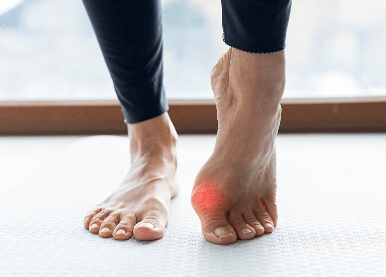 Halluks Valgus İçin Doğru Ayakkabı Seçiminin Önemi