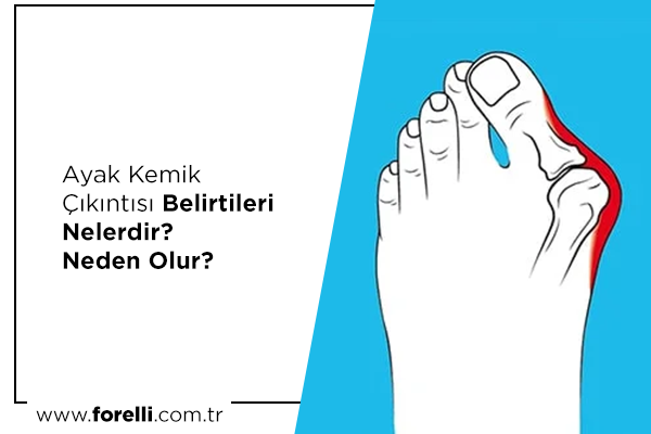 Ayak Kemik Çıkıntısı Belirtileri Nelerdir? Neden Olur?