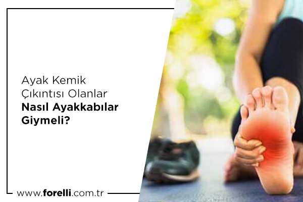 Ayak Kemik Çıkıntısı Olanlar Nasıl Ayakkabılar Giymeli?