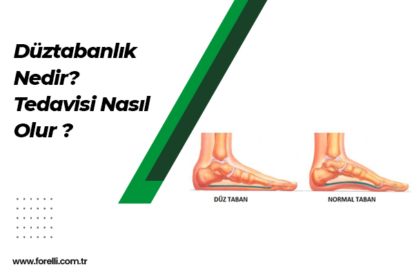 Düztabanlık Nedir? Tedavisi Nasıl Olur ?