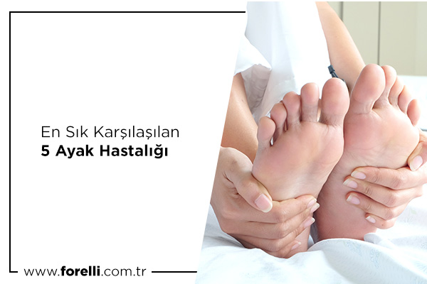 En Sık Karşılaşılan 5 Ayak Hastalığı